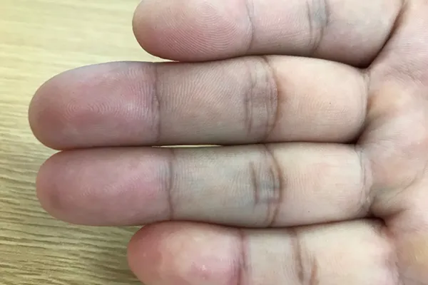 手指上的斗和簸箕代表什么意思(斗和簸箕暗示了啥)